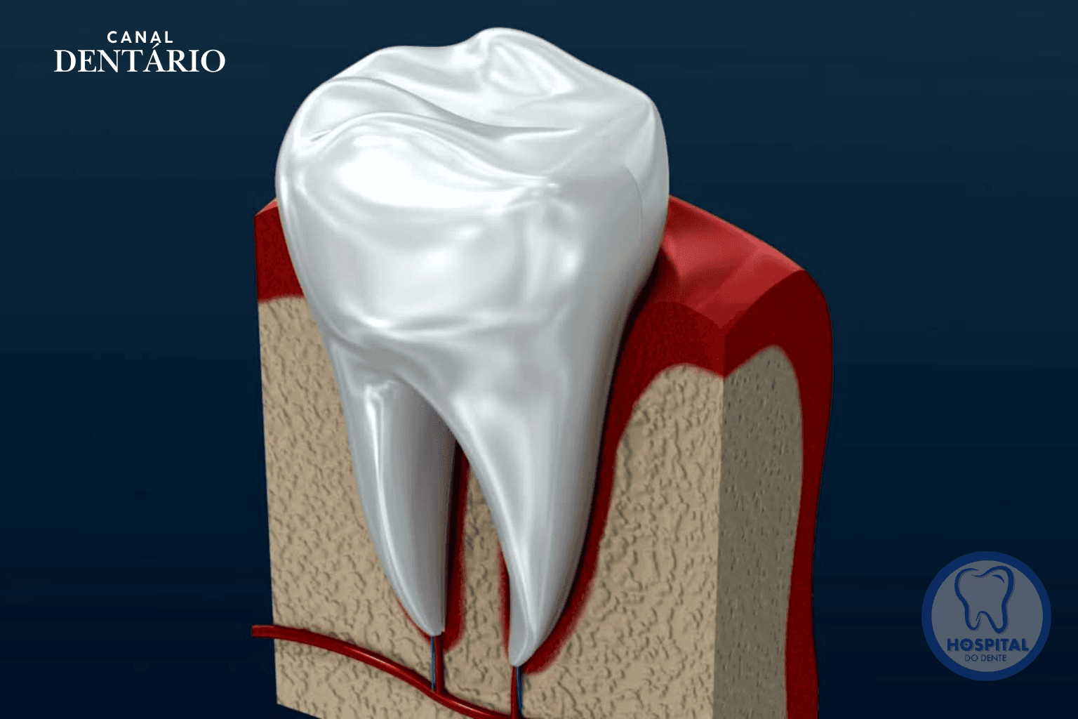 canal dentário itapetining
