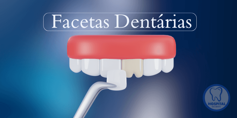 Facetas Dentárias Hospital do Dente Itapetininga