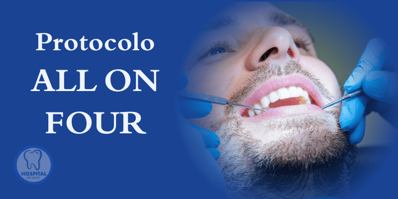 Protocolo All on Four - Dentista em Itapetininga